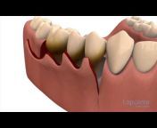 Lapointe dental centres