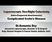 Laparoscopic Surgery- Dr. SUMANTA DEY