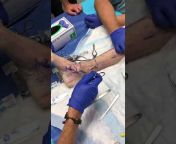 Orthoplastic Limb Videos u0026 Surgical Pearls- IOMS