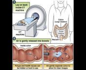 learning radiology
