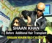 shaun khan