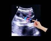 Ultrasound Dr Samra ke sath