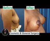 Cosmetic u0026 General Surgery