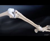 What&#39;s New in Orthopedics