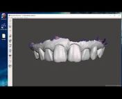 The 3D Dentist - Michael D Scherer, DMD, MS