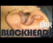 Dr. Lalit Kasana - Skin Treatment