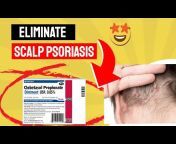 Psoriasis on Youtube