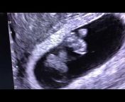 Dr. Gil Wilshire, MD &#124; Missouri Fertility