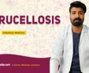 Brucellosis is an Infectioncaused by bacteria and is categorized as one of the Bacterial Human Diseases. Learn about Brucellosis in detail in this online Infectious Medicine Lecture which explains brucellosis etiology, Immunityand pathophysiology of brucellosis along with its clinical features. More in this V-Learning™ is the diagnosis and treatment as well as the difference between brucellosis and Tuberculosis.nn-------------------------------------------------------------nInfectious Medi