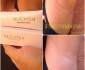 Nlighten Underarm CreamnNet wt. 30gnn📍Formulated with ten(10) powerful botanical ingredients, i.e. star lily, shea butter, pomegranate, mulberry, fig, ginkgo, black rice, blueberry, green tea and houttuynia cordatan📍Promotes instant brightening effect and through its especial activesn📍Helps maintain soft underarmn📍effectively helps in reducing dark spots and other visible hyperpigmentationnnFor all skin types...nn🔹Made in Korean🔹Instant Effectn🔹Safe &amp; Effectiven🔹FDA a