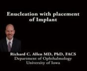 This is Richard Allen at the University of Iowa. This video demonstrates an enucleation with placement of a porous polyethylene implant.The patient in this video had a choroidal melanoma.A 360 degree conjunctival peritemy is performed with Westcott scissors. Dissection is then performed in each of the quadrants between the rectus muscles with Stevens scissors.A Von Graefe muscle hook is used to hook the medial rectus muscle.This is often then transferred to a Green hook.The rectus musc