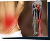 Do you want to cure your sharp shooting pains from the lower back on down to the feet? naturally and to get rid of your sciatica constant pain permanently. You will be able to learn the secrets of curing your sciatica, in just minutes from now. Click Here to watch this FREE Video! - nhttp://www.clickbank-reviews.net/2015/09/sciatica-why-you-have-been-treating-it.htmlnDo you or someone you know ever experience sharp shooting pains from the lower back on down to the feet? Nearly every family in th