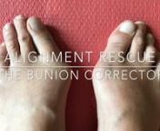 Purchase my two hour course on Bunions here:nhttps://healthymoving.com/bunionworkshop/?index=6623nUsing a ball and a band, start to align the hallux (great or big toe) phalanges with its metatarsal. Movement at the MP joint can be limited by the articulating surface of this joint in a bunion, and creating a better relationship between them can help strengthen the associated muscles of the toe.