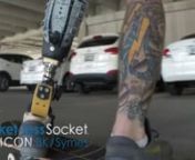 Learn more about the ICON™ BK at MartinBionics.com or call 844.MBIONIC (844.624.6642).nnTalk to a Socket-less Socket™ expert here: https://bit.ly/3ydyfcw