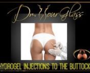Hydrogel is one of the most common underground products used to augment the gluteal area. Similar to fillers used in the face, hydrogel is in liquid material form. However, in the case of the buttock augmentation, it is used in very high quantities.It is worth noting that hydrogel causes problems when you inject a high amount into your body. As a result, hydrogel injections comes with its own complications when performing a buttock augmentation. I have seen patients who have used hydrogel inje