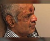 Indian left bleeding in hate crime in New Jersey from bleeding crime indian