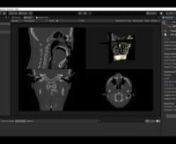 Scientific data processing and visualization in Unity, leveraging the Visualization Toolkit (VTK) library.nThe VTKUnity-Activiz package provides a Unity wrapper around the VTK library for your scientific and medical imaging needs.
