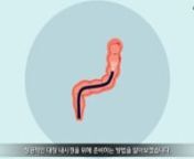 (Korean) GAVILYTE COLONOSCOPYBOWEL PREP from gavilyte