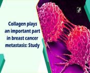 Collagen type XII is essential for controlling how the tumour matrix is organised, according to a recent study from the Garvan Institute of Medical Research. &#60;br/&#62;&#60;br/&#62;High levels of collagen XII can cause breast cancer cells to metastasize, or spread from the primary tumour to different parts of the body, according to research conducted by a team of scientists led by Associate Professor Thomas Cox, Head of the Matrix and Metastasis lab. &#60;br/&#62;&#60;br/&#62;The extracellular matrix is a part of the ecosystem that surrounds a tumour and is known as the tumour microenvironment. Cancer cells and the tumour microenvironment are constantly interacting, which has an impact on how a tumour develops. &#60;br/&#62;&#60;br/&#62;Although collagen plays a significant role in the tumour microenvironment, it is unclear how exactly collagen affects tumours. According to the research, it may be possible to use measuring the amount of collagen XII in a patient&#39;s tumour biopsy as an additional screening tool to find metastatic breast cancers that are more likely to be aggressive, like the triple-negative variety. &#60;br/&#62;&#60;br/&#62;In addition, future therapies might consider targeting collagen XII. According to the first author, Michael Papanicolaou from Garvan, said: “Collagen XII seems to be changing the properties of the tumour and making it more aggressive.” &#60;br/&#62;&#60;br/&#62;It modifies the organisation of collagens to facilitate cancer cells escaping from the tumour and travelling to other locations, such as the lungs. &#60;br/&#62;&#60;br/&#62;The team then altered collagen XII production using genetic engineering and examined the outcomes of metastasis to other organs. They discovered that metastasis increased along with collagen XII levels. &#60;br/&#62;&#60;br/&#62;These findings were later confirmed in human tumour biopsies, which demonstrated that high levels of collagen XII are linked to worse overall survival rates and higher metastasis. More human samples will be studied in future research, along with potential therapeutic pathways.&#60;br/&#62;