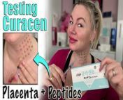 Subscribe&#60;br/&#62;I am loving placenta which is the purest form of stem cells and growth factors to help fight aging and rejuvenate aging skin.&#60;br/&#62;Curacen is no longer avail for purchase, but my FAVORITE Placenta product is! You can do this same treatment with Laennec!&#60;br/&#62;&#60;br/&#62;Get your Laennec Here: https://www.acecosm.com/categories/skin-booster/laennec&#60;br/&#62;***Code Jessica10 saves you Money&#60;br/&#62;Please note code Jessica10 is an affiliate link which means when you use it I make a small commission :)&#60;br/&#62;On this channel we talk about LIFE and I share MY OPINION. THIS IS JUST MY OPINION. You can and should speak to a professional and others in your life about any and all things that we discuss on this channel, this is just what I have to say based on my experience. SO do your own research please :)&#60;br/&#62;Join Locals - our Subscription Community (It&#39;s &#36;5 a month): https://wannabebeautygurus.locals.com&#60;br/&#62;&#60;br/&#62;Also email me if you want to be on the daily email blast list, or with questions: jessicajlcameron@yahoo.com&#60;br/&#62;&#60;br/&#62;My Priority Links (Youtube channels, Rumble, Favorite Skin Care and more) : https://qrco.de/bdAMP3&#60;br/&#62;&#60;br/&#62;If you would like to make a donation towards my content, please do so here (there are several ways to do so) but please note that it is not required in any way: https://www.wannabebeautyguru.com/donations&#60;br/&#62;&#60;br/&#62;We have MERCH! Get yours here: https://wannabe-beauty-guru.myspreadshop.com/&#60;br/&#62;&#60;br/&#62;You can see more videos, vlogs and resources for FREE over on my website: https://www.wannabebeautyguru.com (all I ask is when ordering please use my codes, I do get a small kick back and you save &#36;&#36;&#36;&#36; so it&#39;s a win win :)&#60;br/&#62;&#60;br/&#62;Join our facebook Group filled with wonderful, supportive skin care enthusiasts ! https://www.facebook.com/groups/553814011993661&#60;br/&#62;&#60;br/&#62;Join our NEW TO DIY Facebook group: https://www.facebook.com/groups/1626549951146756/&#60;br/&#62;&#60;br/&#62;My Channels - PLEASE SUBSCRIBE and HIT the BELL!&#60;br/&#62;~ Bitchute : https://www.bitchute.com/channel/axSbKNoHdhbj/&#60;br/&#62;&#60;br/&#62;~ Rumble: https://rumble.com/user/WannabeBeautyGuru&#60;br/&#62;&#60;br/&#62;~Discord: Here is the link to join the Discord group! https://discord.gg/bA7Cp9vA7j&#60;br/&#62;&#60;br/&#62;Instagram: https://www.instagram.com/wannabebeautygurujc/?hl=en&#60;br/&#62;&#60;br/&#62;Twitter: https://twitter.com/Wannabebeautyjc&#60;br/&#62;&#60;br/&#62;Things I love :&#60;br/&#62;~ Amazon Store : https://www.amazon.com/shop/influencer-a0791280&#60;br/&#62;~ www.acecosm.com https://bit.ly/3ANGX1Q (where you can buy Korean skin Care and more) ***Use code Jessica10 to save the most money*****&#60;br/&#62;~ www.maypharm.net https://bit.ly/3B4rVoA (where you can buy Korean skin Care , and more) ***Use code Jessica10 to save 13%*****&#60;br/&#62;~ www.glamcosm.com https://bit.ly/2XFdadc (where you can buy Korean skin Care, and more) ***Use code Jessica10 to save the most money*****&#60;br/&#62;~ www.glamderma.com https://bit.ly/2XFdadc (where you can buy Korean skin Care, and more) ***Use code Jessica10 to save the most money*****&#60;br/&#62;~ https://www.platinumskincare.com (where you can buy Peels, after care and more) ***Use code Jessica10 to save 10%*****&#60;br/&#62;~ Plasma Perfecting for your Skin Care devices (including radio frequency micronee