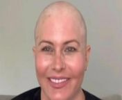 Nicole Eggert proudly shaved her head after vowing to never be &#92;