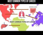 Most common types of cancer #oncology #cancer