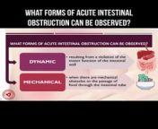 What forms of acute intestinal obstruction can be observed? #intestine #intestinalobstruction #pain